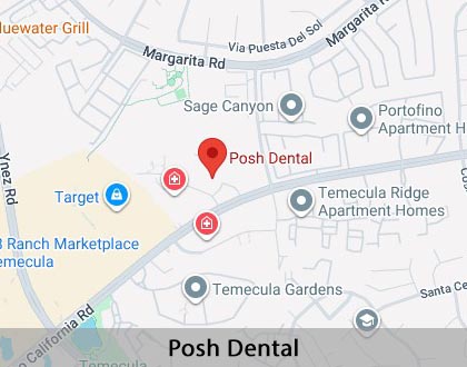 Map image for Invisalign in Temecula, CA