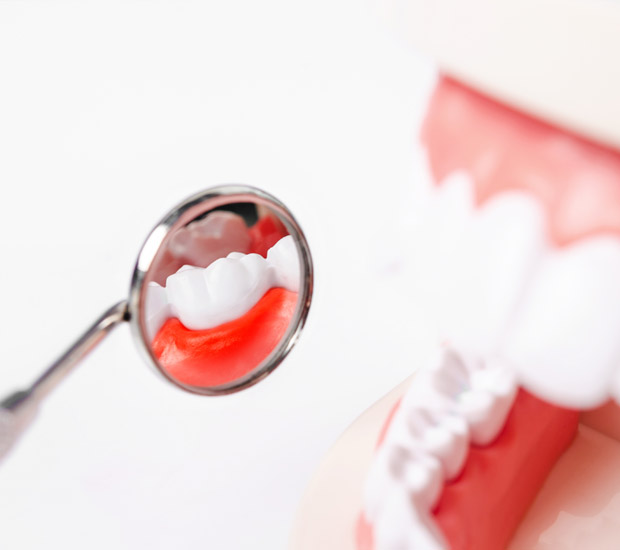 Temecula Interactive Periodontal Probing